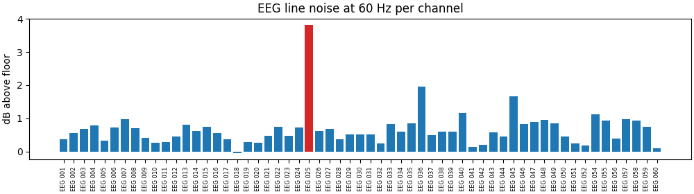 EEG line noise at 60 Hz per channel