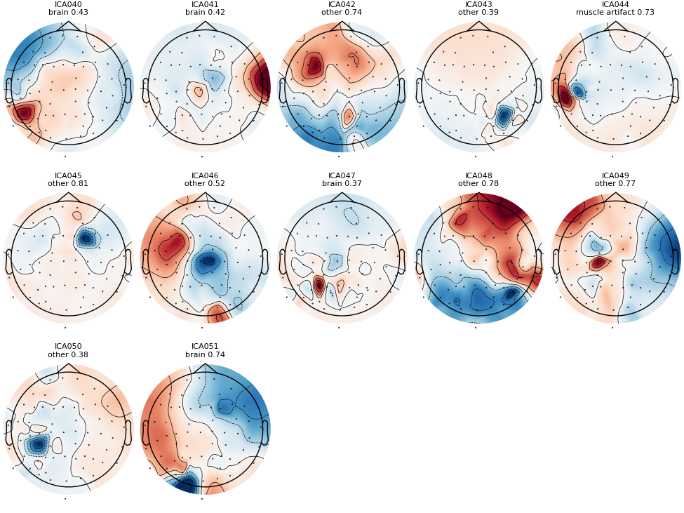 ICA040 brain 0.43, ICA041 brain 0.42, ICA042 other 0.74, ICA043 other 0.39, ICA044 muscle artifact 0.73, ICA045 other 0.81, ICA046 other 0.52, ICA047 brain 0.37, ICA048 other 0.78, ICA049 other 0.77, ICA050 other 0.38, ICA051 brain 0.74