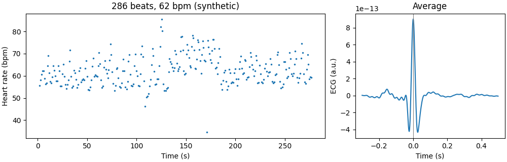 286 beats, 62 bpm (synthetic), Average