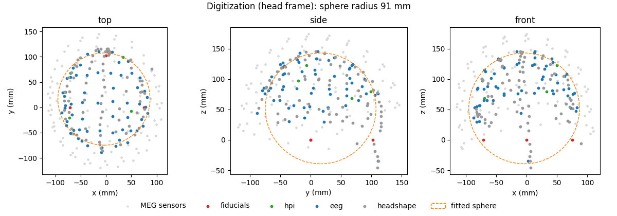 Digitization (head frame): sphere radius 91 mm, top, side, front
